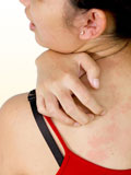 Картинка-анонс к статье Причины аллергии на спине и животе