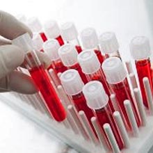 Картинка-анонс к статье Процесс сдачи анализа крови ПСА: подготовка и расшифровка
